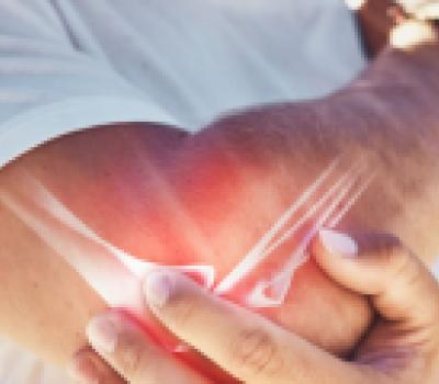 Lokalno samozdravljenje bolečine